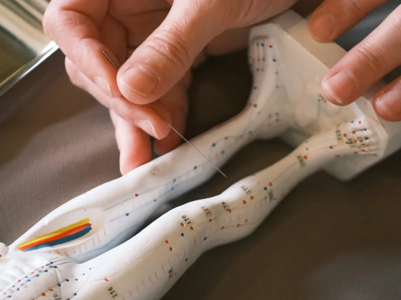 Acupuncture at Prairie Star Chiropractic in Hudsonville