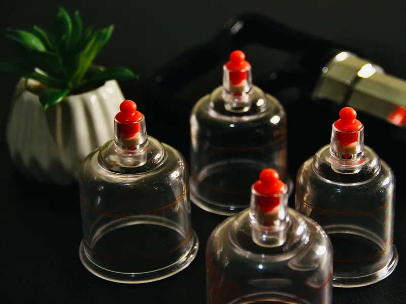 How Cupping Therapy works at Prairie Star Chiropractic