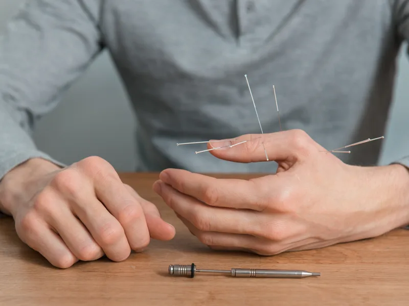 Dry Needling at Prairie Star Chiropractic in Hudsonville