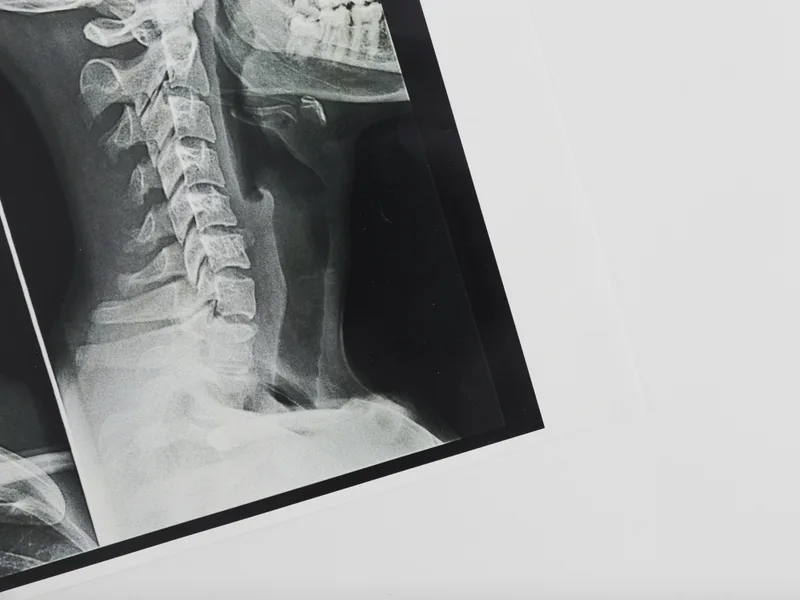 X-Rays at Prairie Star Chiropractic in Hudsonville